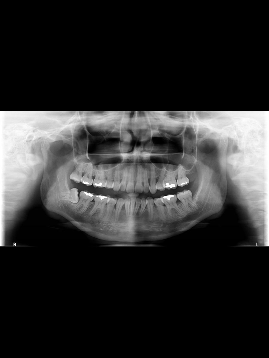 Patología Bucal