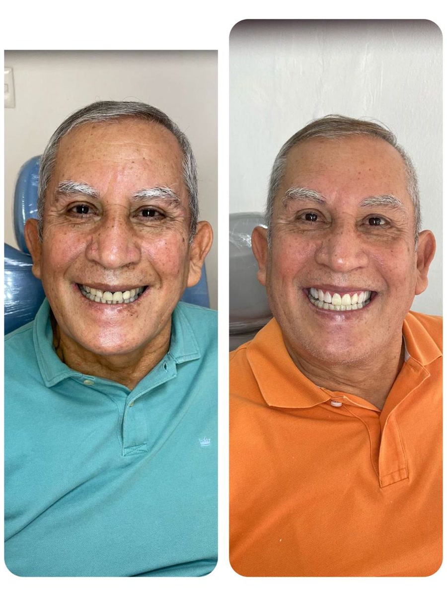 Rehabilitación